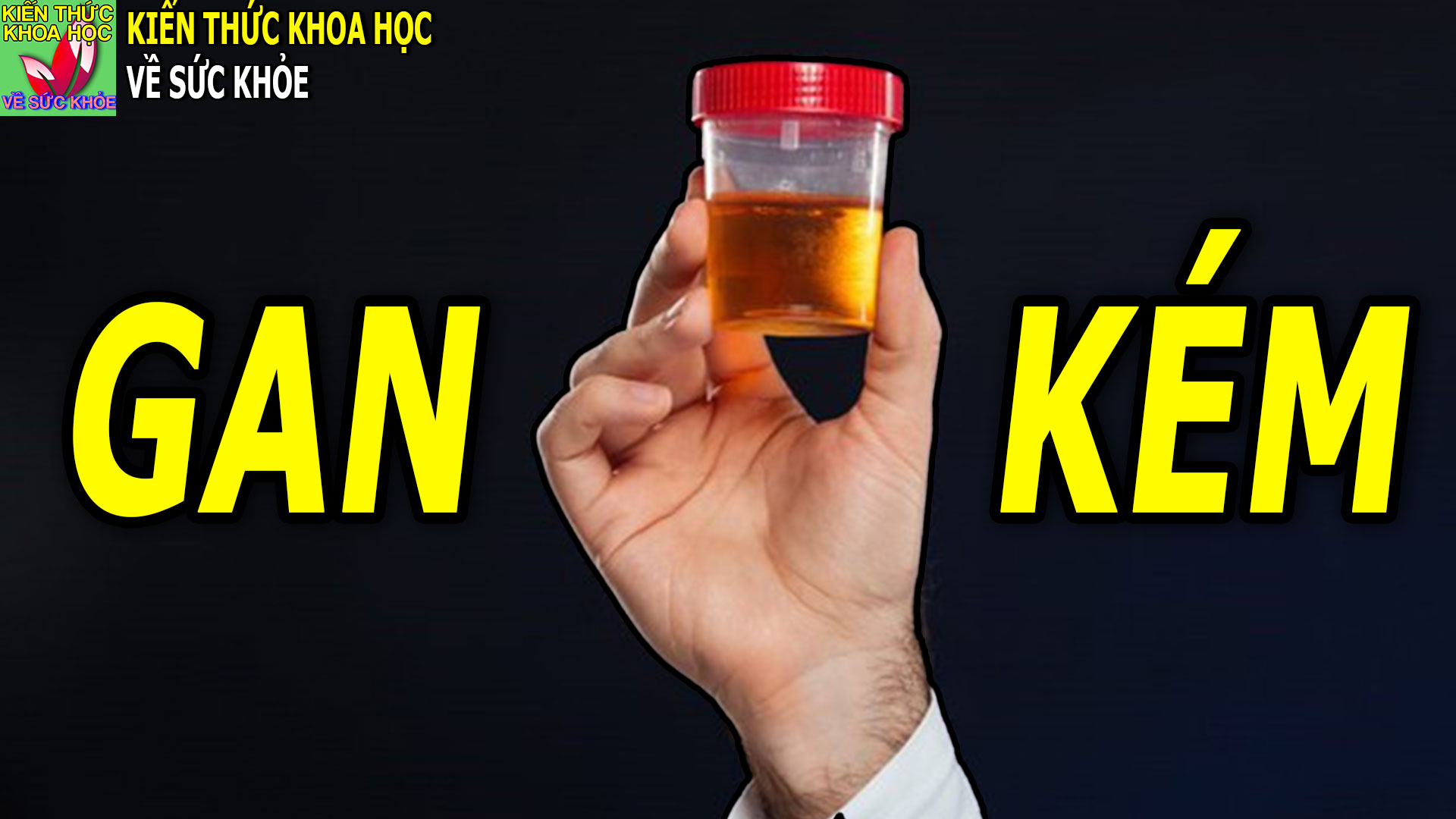 4-dau-hieu-vao-buoi-sang-canh-bao-gan-co-van-de