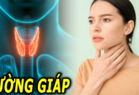 benh-cuong-giap-nen-va-khong-nen-an-gi