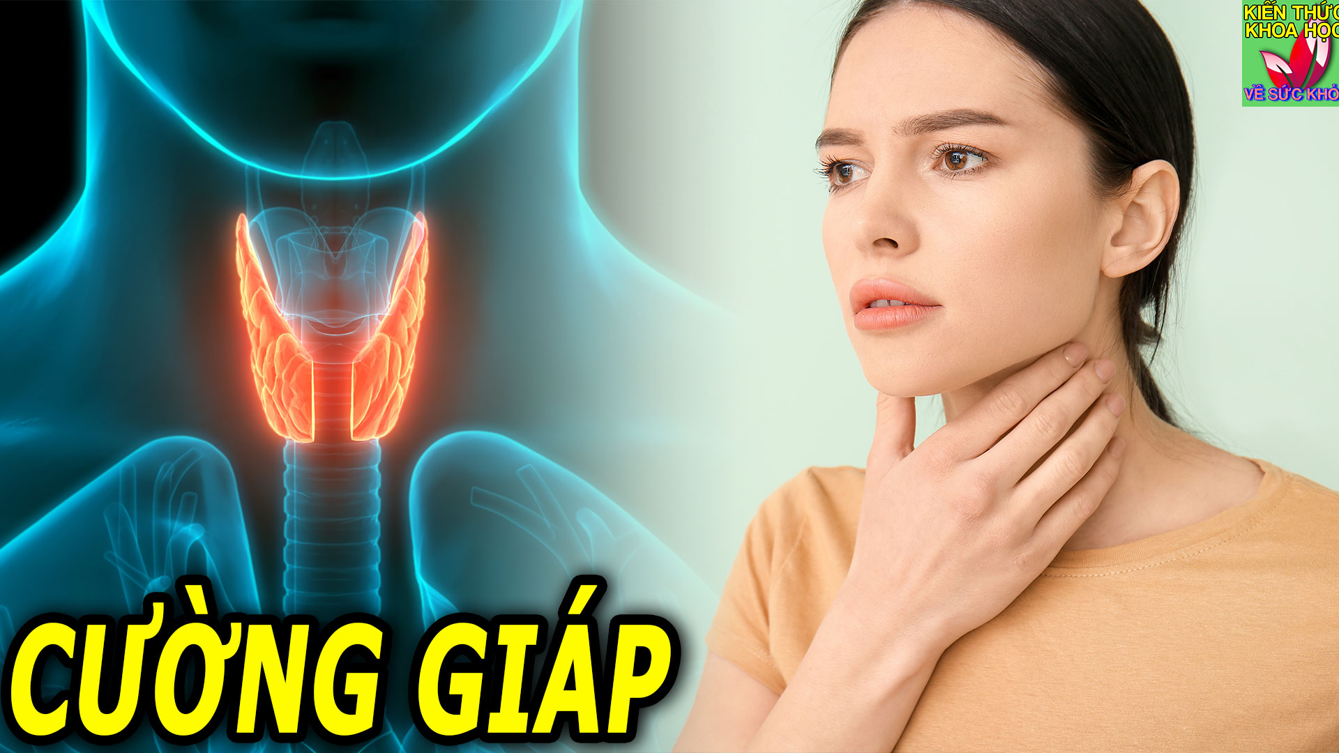 benh-cuong-giap-nen-va-khong-nen-an-gi