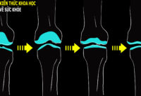 bo-phan-rat-de-bi-thoai-hoa-am-tham-ma-khong-co-dau-hieu-bao-truoc