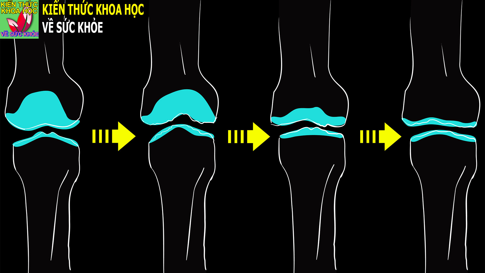 bo-phan-rat-de-bi-thoai-hoa-am-tham-ma-khong-co-dau-hieu-bao-truoc