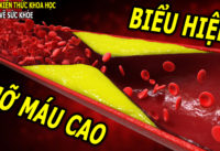 nguoi-gay-nhu-que-cui-van-co-the-bi-mo-mau-cao