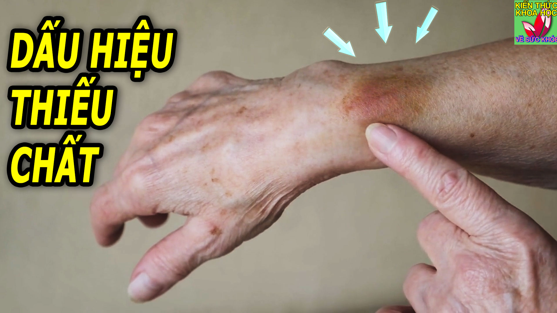9-dau-hieu-canh-bao-o-nguoi-an-uong-thieu-chat