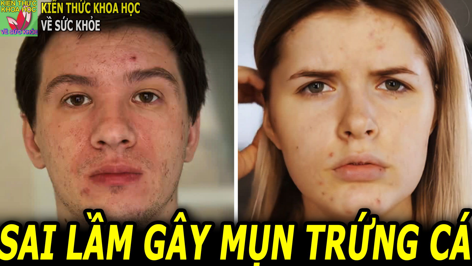 nguyen-nhan-bi-mun-trung-ca