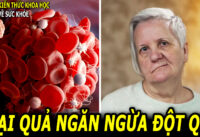 thuong-xuyen-an-loai-qua-nay-co-the-giup-giam-den-55%-nguy-co-dot-quy