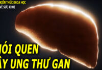 7-thoi-quen-pho-bien-co-the-dan-den-ung-thu-gan