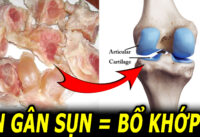 an-nhieu-gan-heo-gan-bo-sun-ga-lieu-co-giup-bo-khop