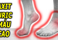 axit-uric-trong-mau-cao-nen-an-gi-kieng-gi