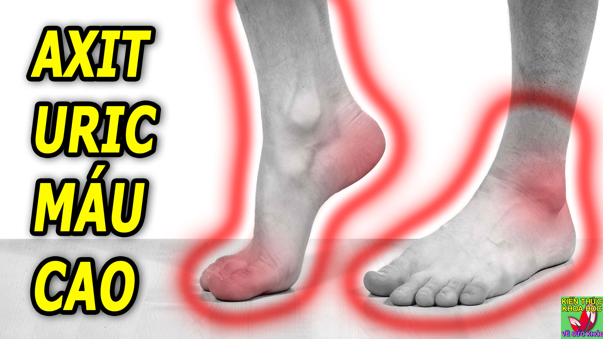 axit-uric-trong-mau-cao-nen-an-gi-kieng-gi