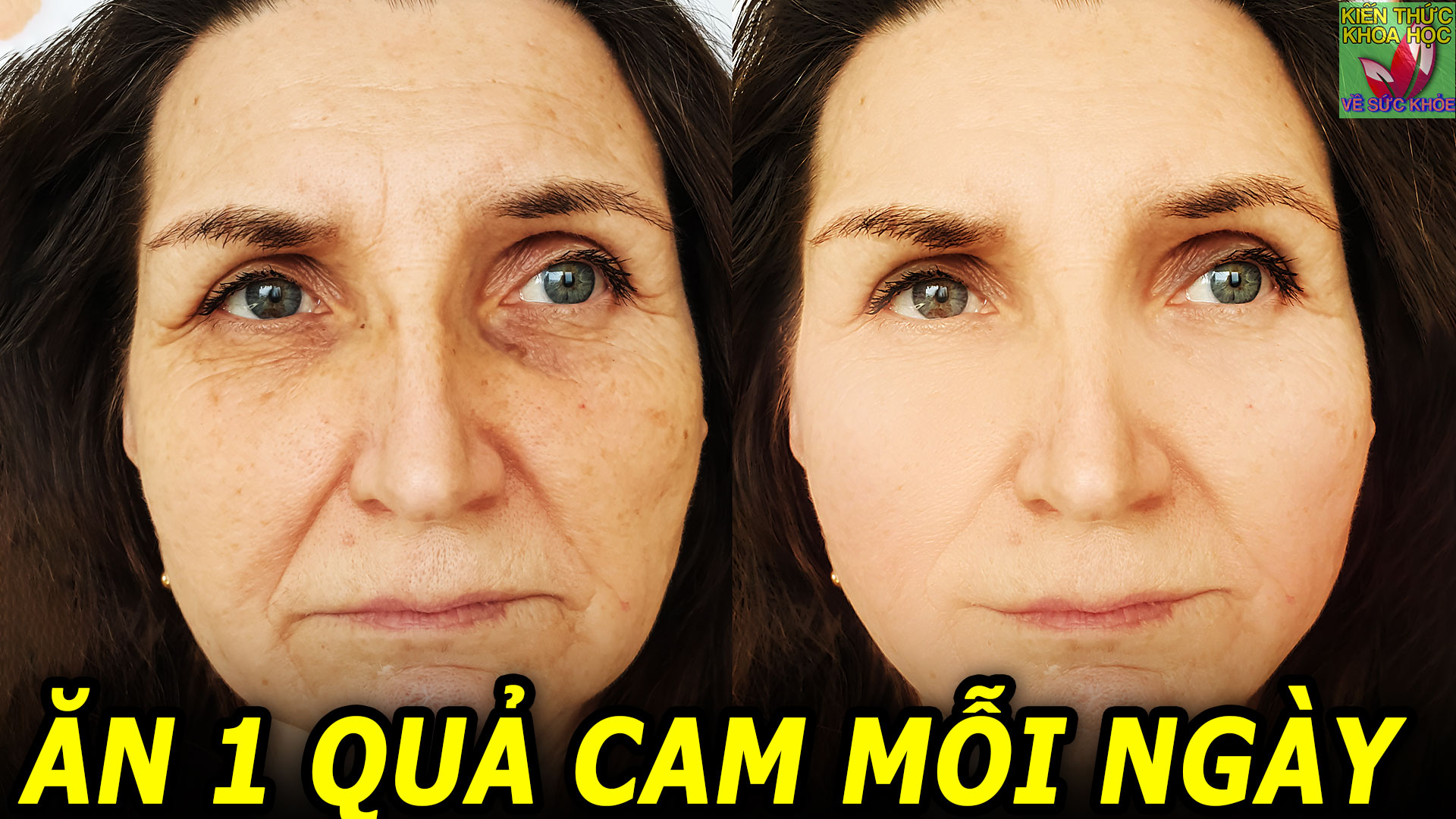 Mỗi ngày ăn 1 quả cam điều gì sẽ xảy ra với cơ thể bạn