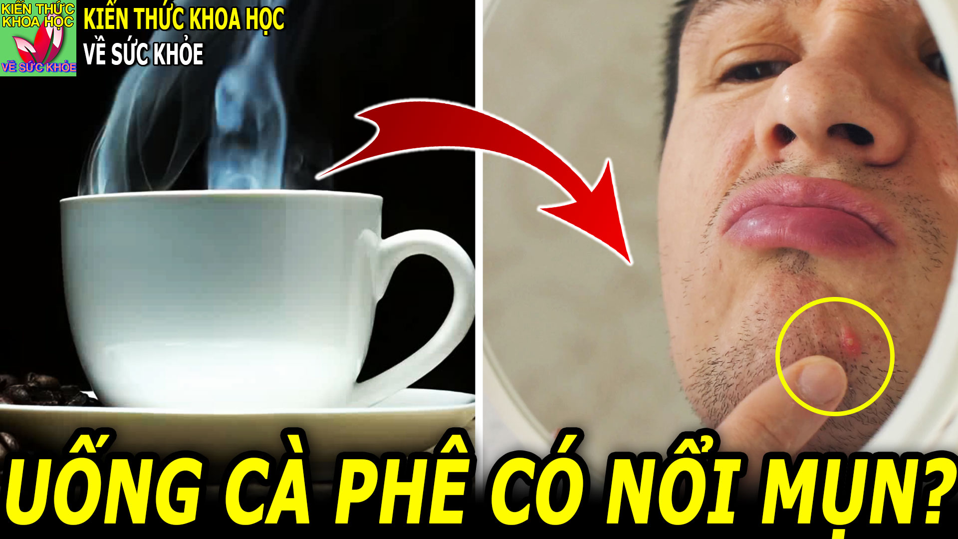 uong-ca-phe-co-noi-mun-khong