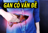 3-bieu-hien-canh-bao-gan-co-van-de-tuyet-doi-khong-nen-chu-quan