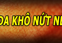cach-lam-cho-da-khong-bi-kho-nut-khi-thoi-thiet-thay-doi
