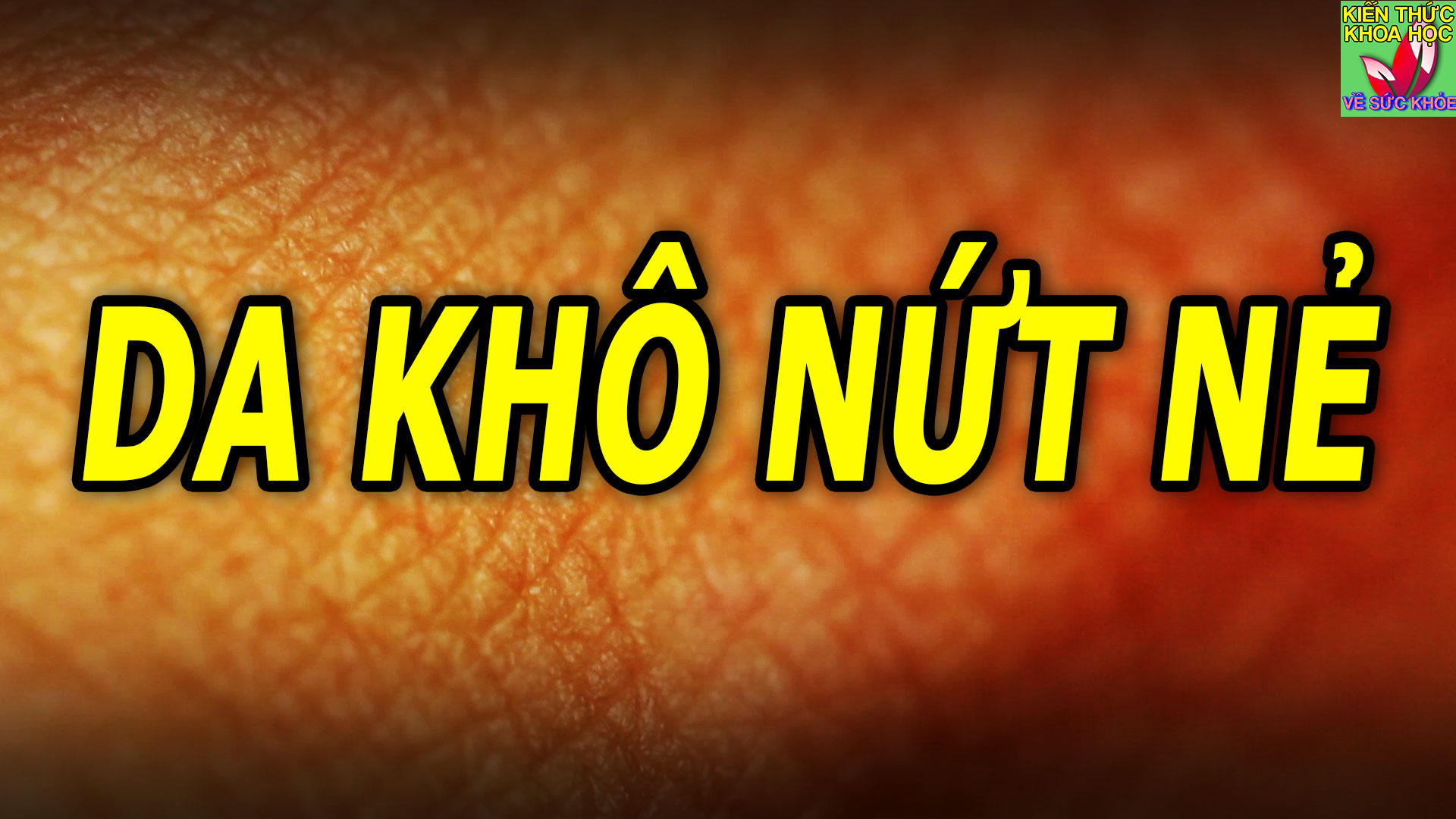 cach-lam-cho-da-khong-bi-kho-nut-khi-thoi-thiet-thay-doi