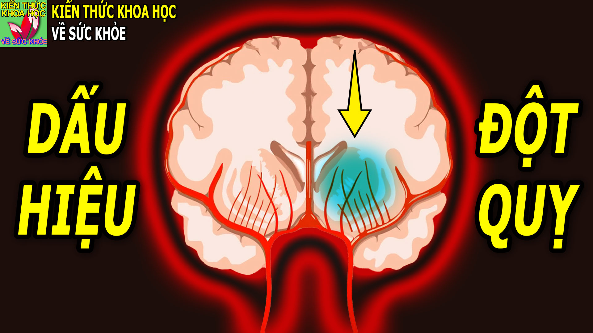 dot-quy-co-trieu-chung-gi-va-lam-sao-de-phong-tranh
