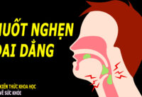 nuot-nghen-la-bieu-hien-cua-benh-gi