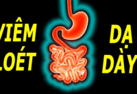 phong-ngua-viem-loet-da-day-ta-trang