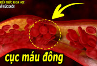 2-loai-thuc-pham-ky-dieu-co-kha-nang-pha-tan-cuc-mau-dong