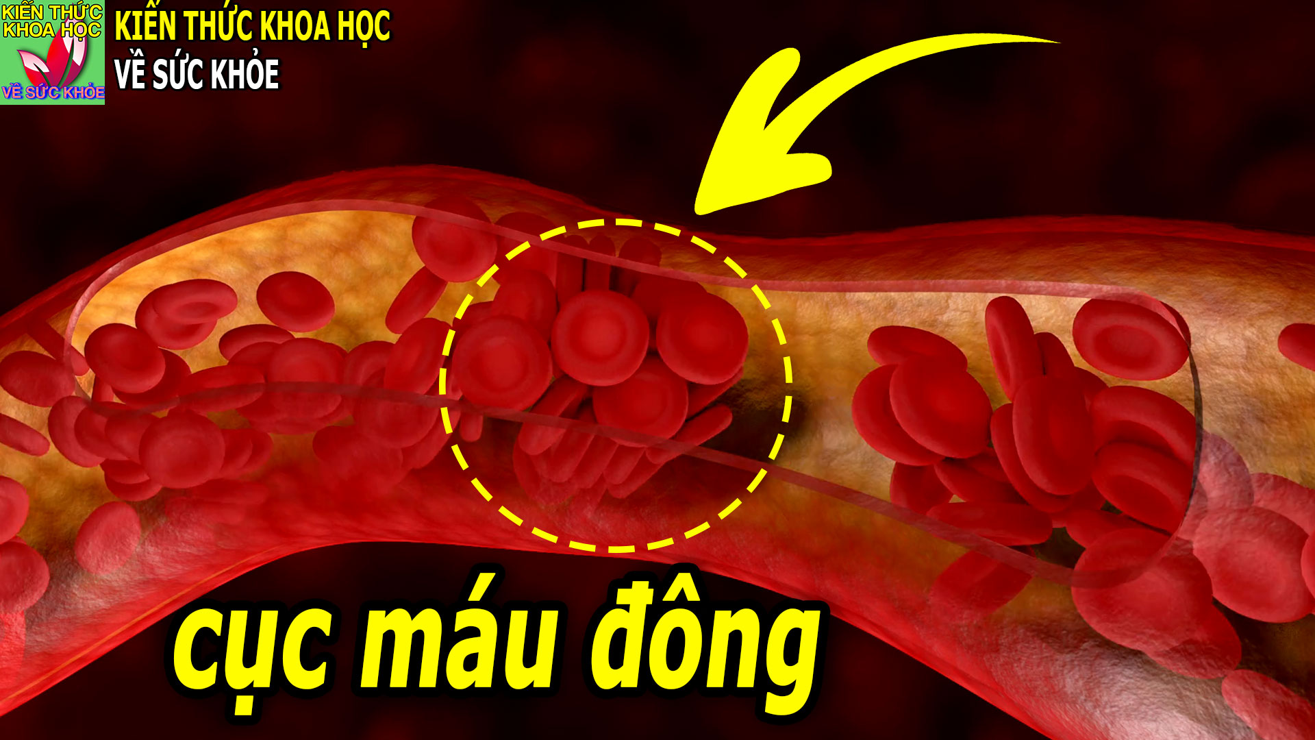 2-loai-thuc-pham-ky-dieu-co-kha-nang-pha-tan-cuc-mau-dong