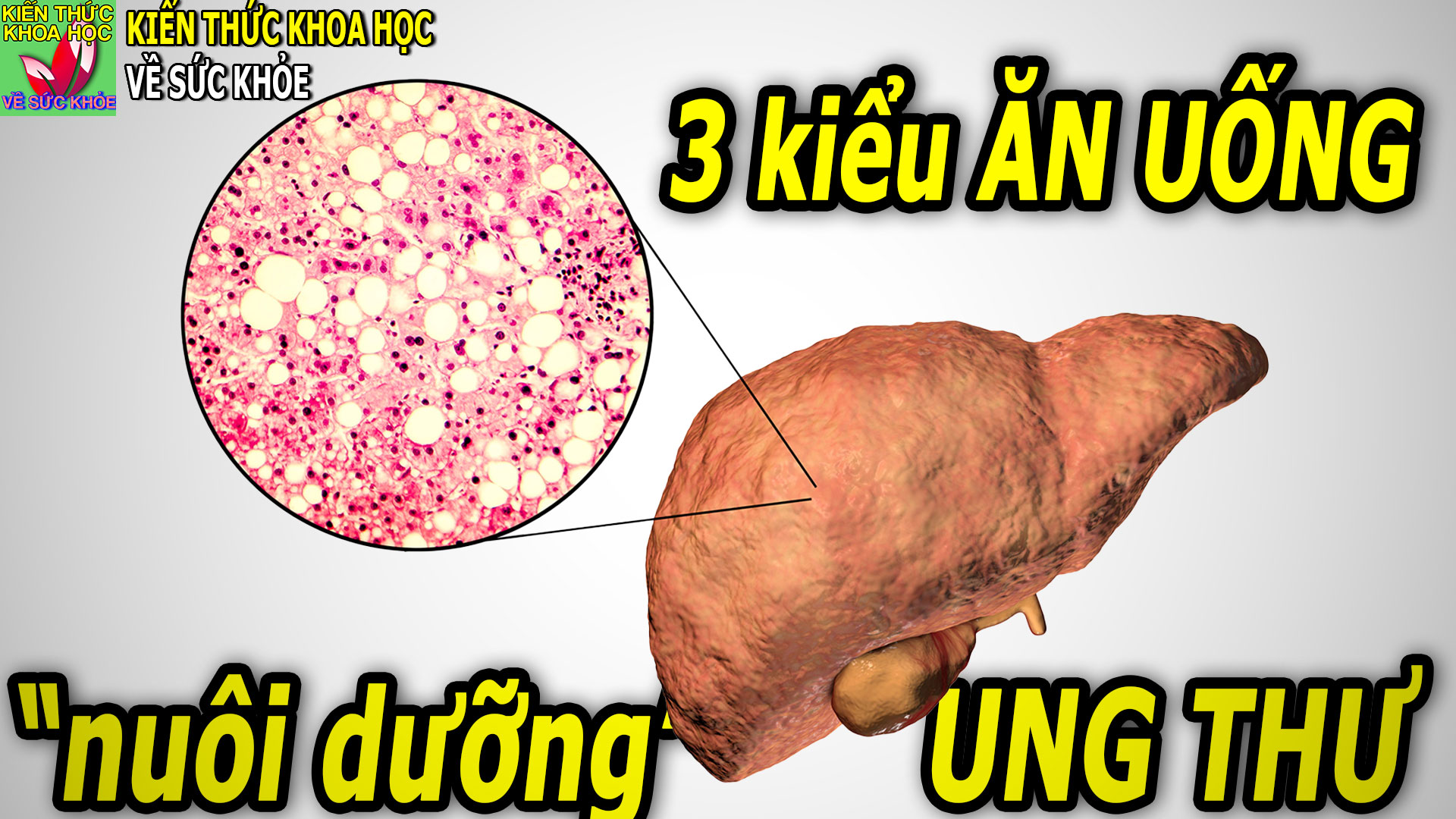 3-kieu-an-uong-pho-bien-lam-tang-nguy-co-mac-ung-thu