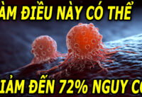 lam-dieu-nay-co-the-giam-den-72%-nguy-co-ung-thu-di-can