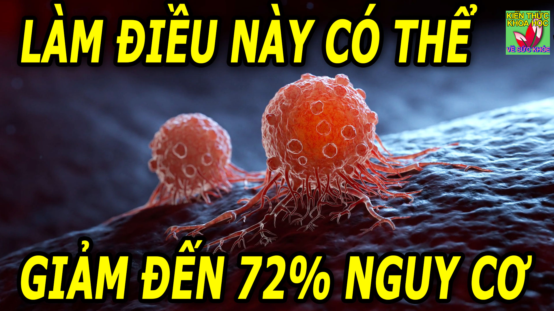 lam-dieu-nay-co-the-giam-den-72%-nguy-co-ung-thu-di-can