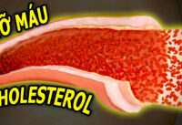 cach-an-uong-de-giam-mo-mau-va-cholesterol
