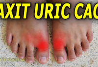 nguoi-bi-axit-uric-cao-nen-va-khong-nen-an-trai-cay-gi