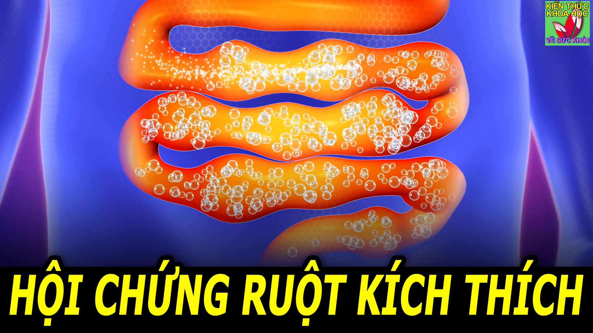hoi-chung-ruot-kich-thich-nguyen-nhan-va-cach-phong-tri