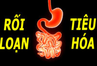 bi-roi-loan-tieu-hoa-khong-nen-uong-gi