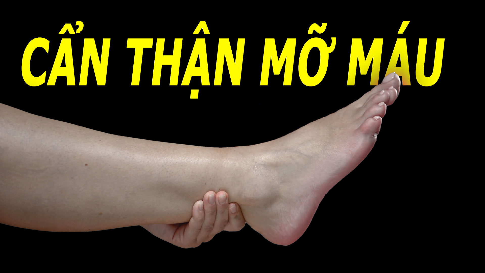 can-than-mo-mau-tang-cao-neu-co-4-dau-hieu-nay-o-ban-chan