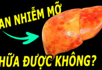 gan-nhiem-mo-co-chua-khoi-duoc-khong