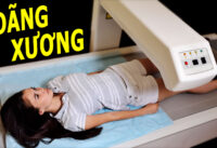 nguyen-nhan-gay-loang-xuong-ma-ban-can-biet