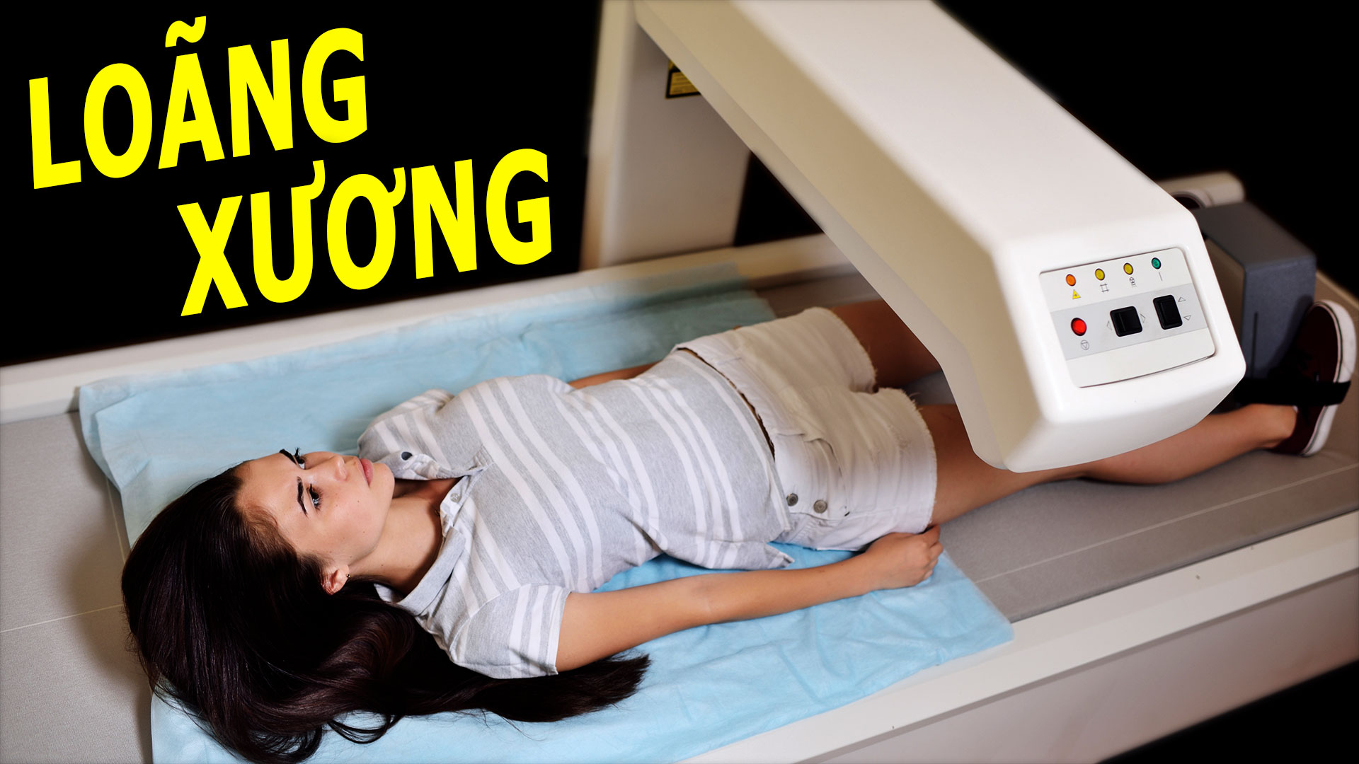 nguyen-nhan-gay-loang-xuong-ma-ban-can-biet