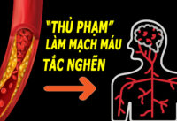 3-loai-thuc-pham-cang-an-nhieu-mach-mau-cang-tac-nghen
