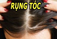 cach-khac-phuc-rung-toc-o-nu-gioi-don-gian-nhat