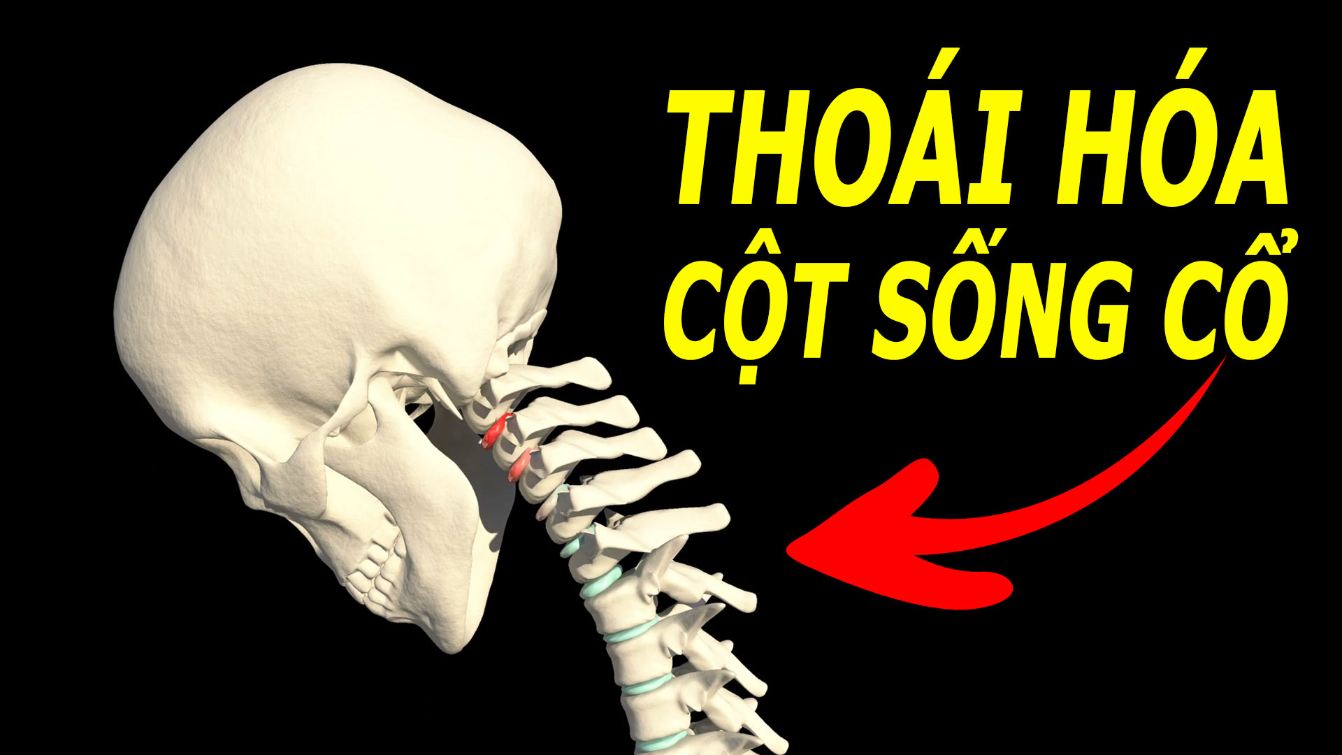 dau-hieu-thoai-hoa-cot-song-co-it-ai-ngo-den