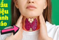 hon-10-dau-hieu-canh-bao-cac-van-de-ve-tuyen-giap