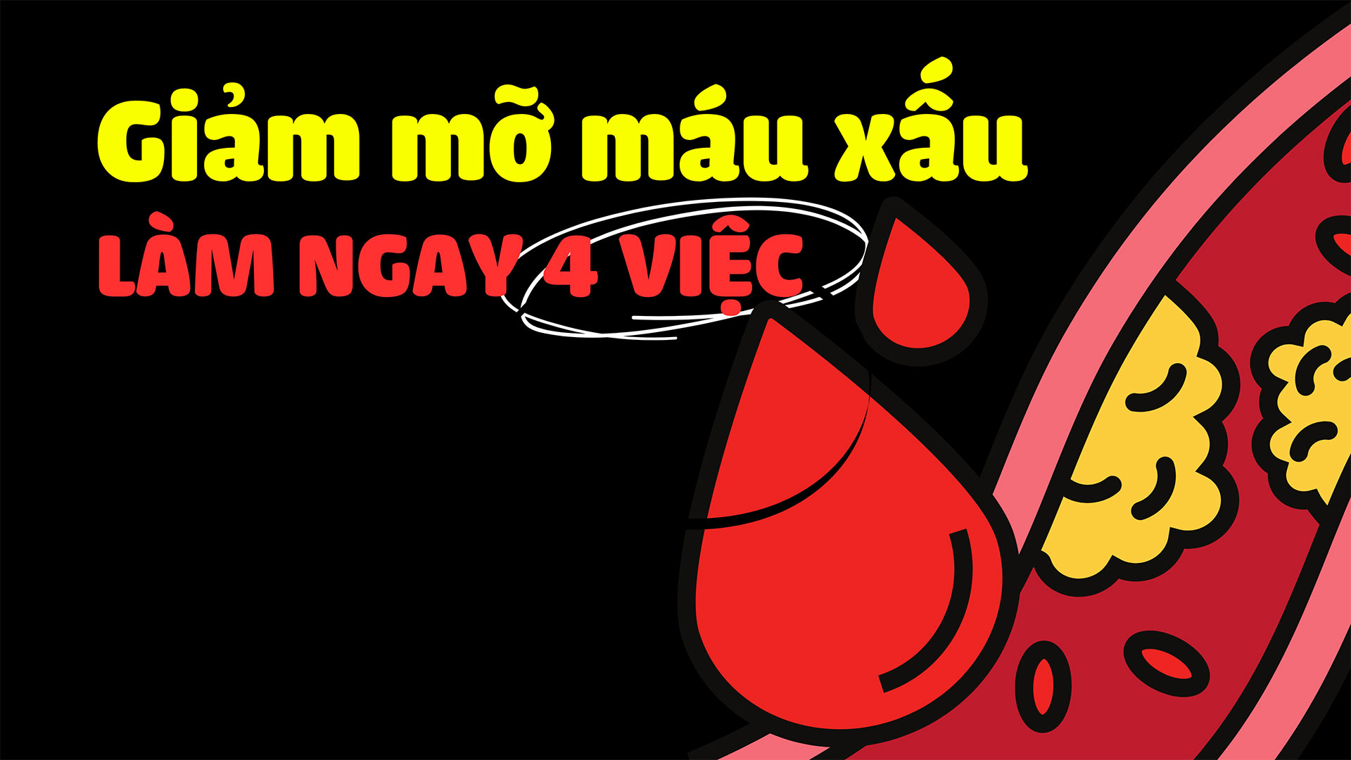 muon-giam-mo-mau-can-thuc-hien-tot-4-viec-nay