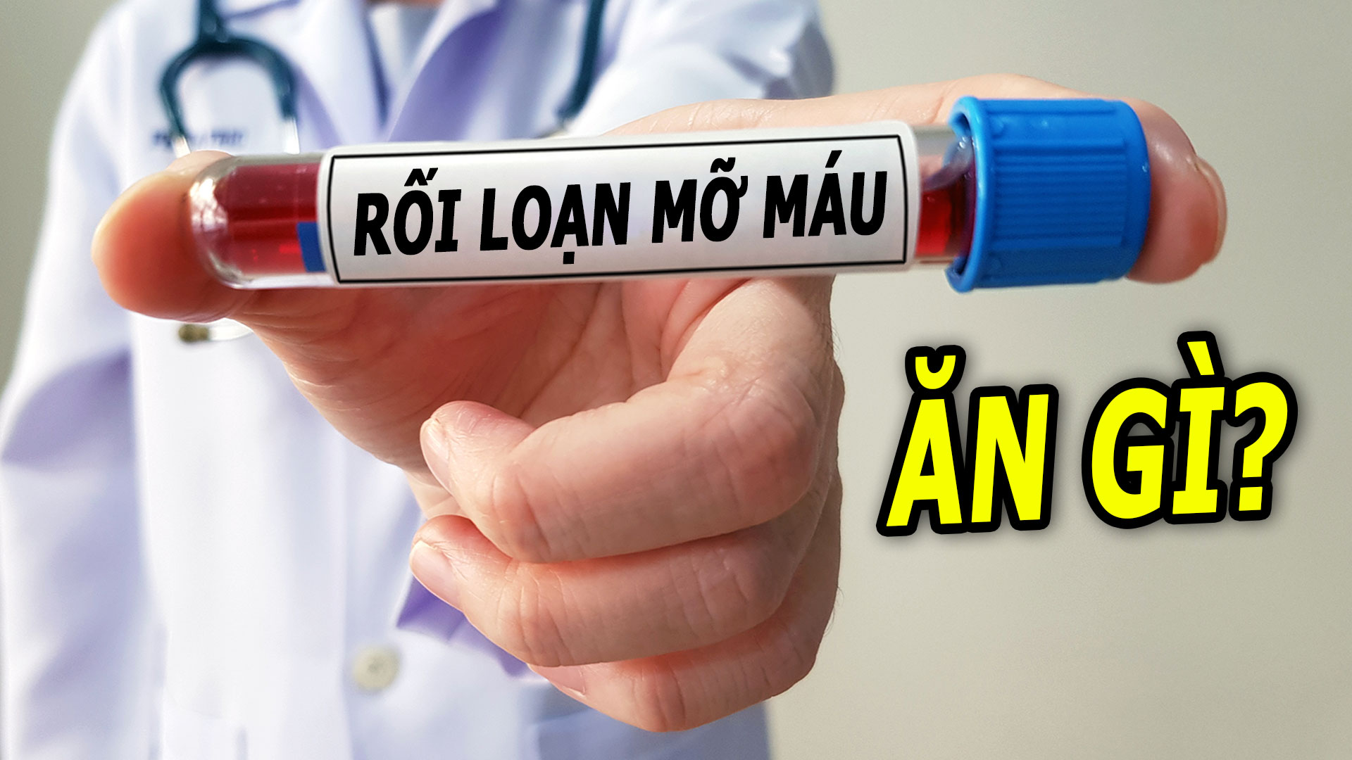 roi-loan-mo-mau-nen-an-gi