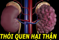 5-thoi-quen-pho-bien-de-gay-hong-than