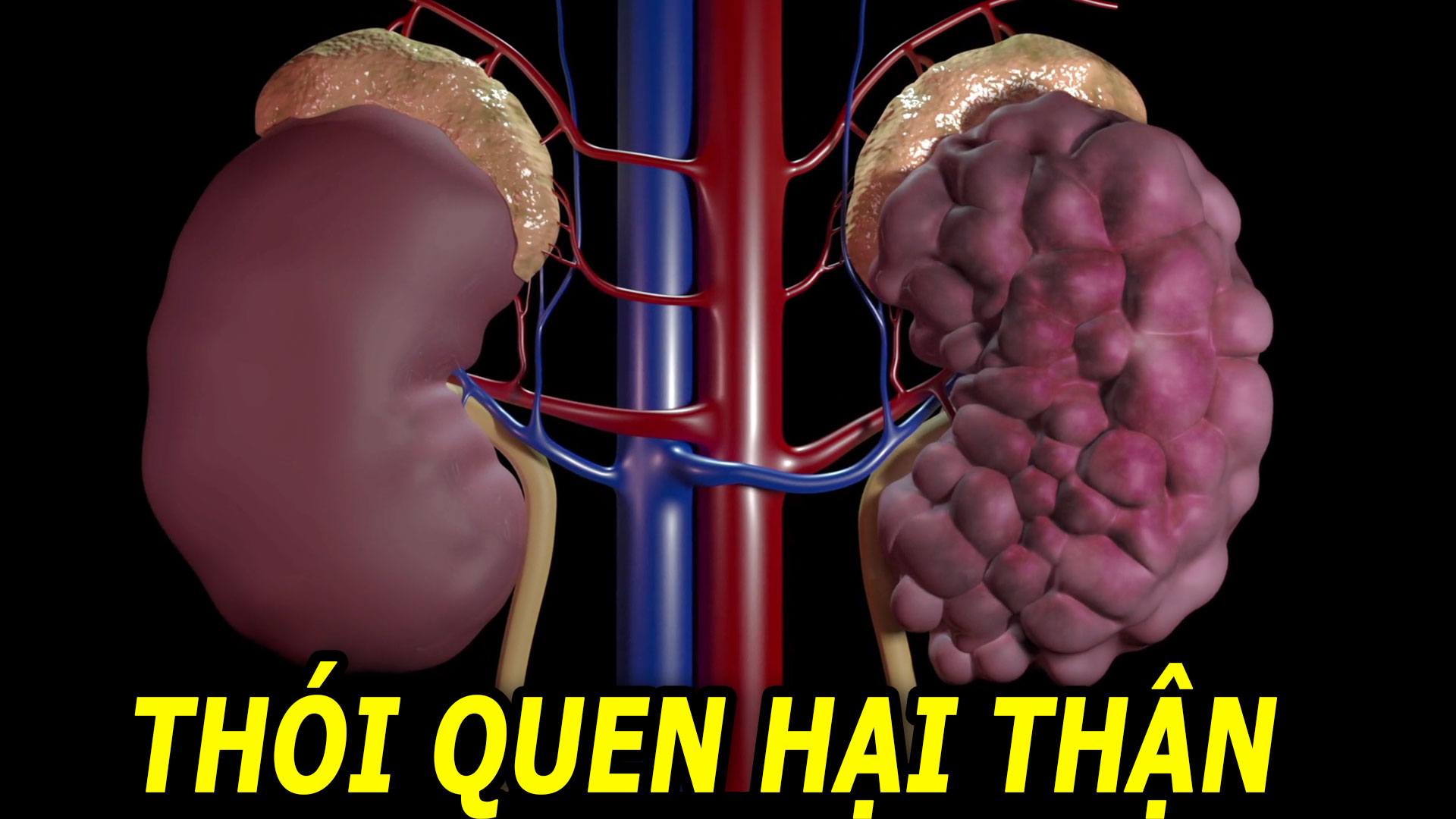 5-thoi-quen-pho-bien-de-gay-hong-than