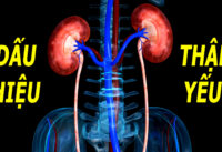 8-dau-hieu-canh-bao-suc-khoe-than-dang-dan-suy-giam