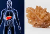 cach-an-uong-giup-ngan-ngua-soi-than-gan-nhiem-mo