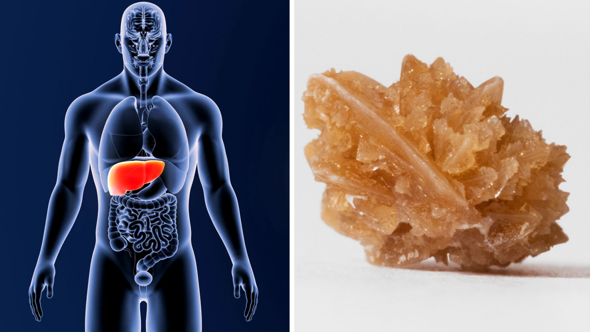 cach-an-uong-giup-ngan-ngua-soi-than-gan-nhiem-mo