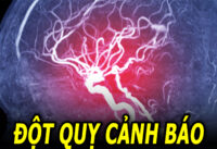 dau-hieu-dot-quy-canh-bao-co-the-xay-ra-truoc-30-ngay