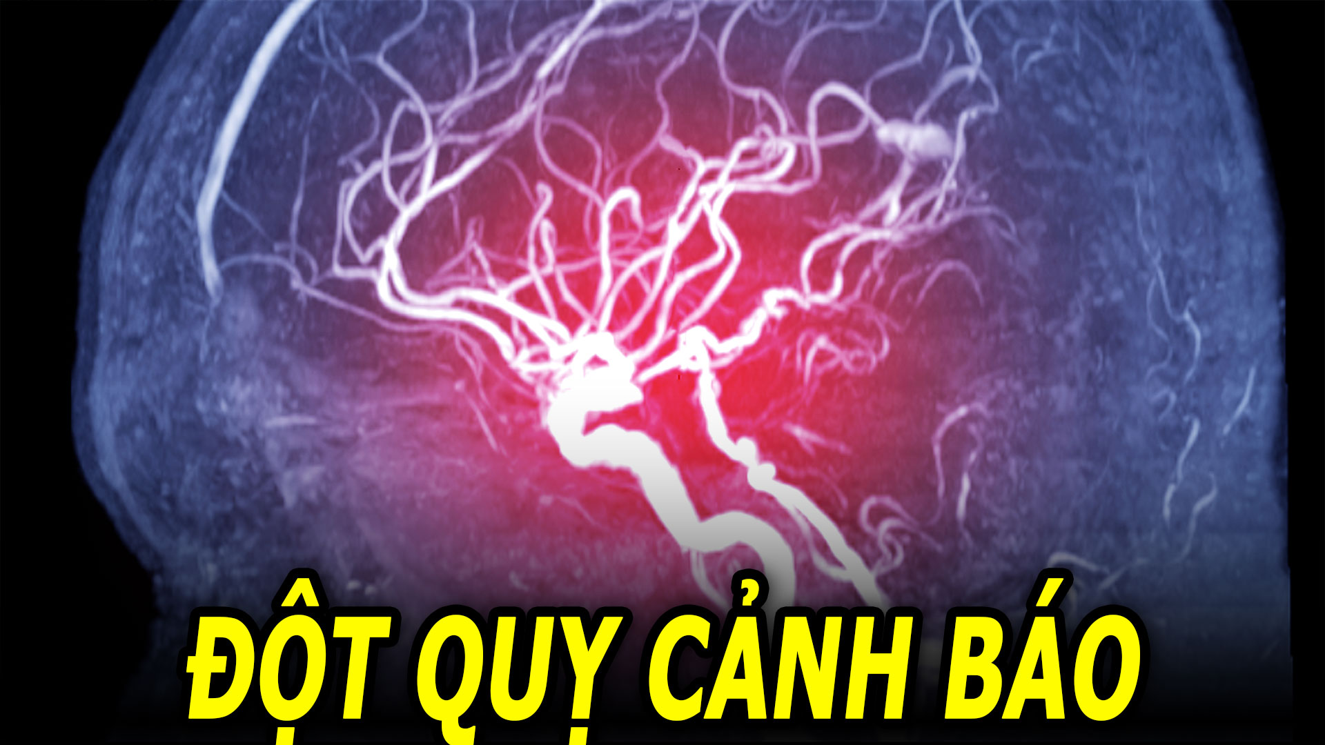 dau-hieu-dot-quy-canh-bao-co-the-xay-ra-truoc-30-ngay