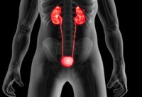 nguoi-benh-tang-huyet-ap-co-the-bi-suy-than-bat-cu-luc-nao