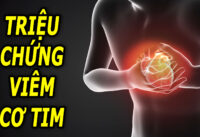 trieu-chung-bao-hieu-benh-viem-co-tim