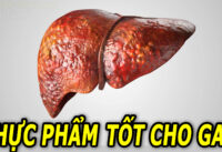 nhung-thuc-pham-tot-va-khong-tot-cho-gan